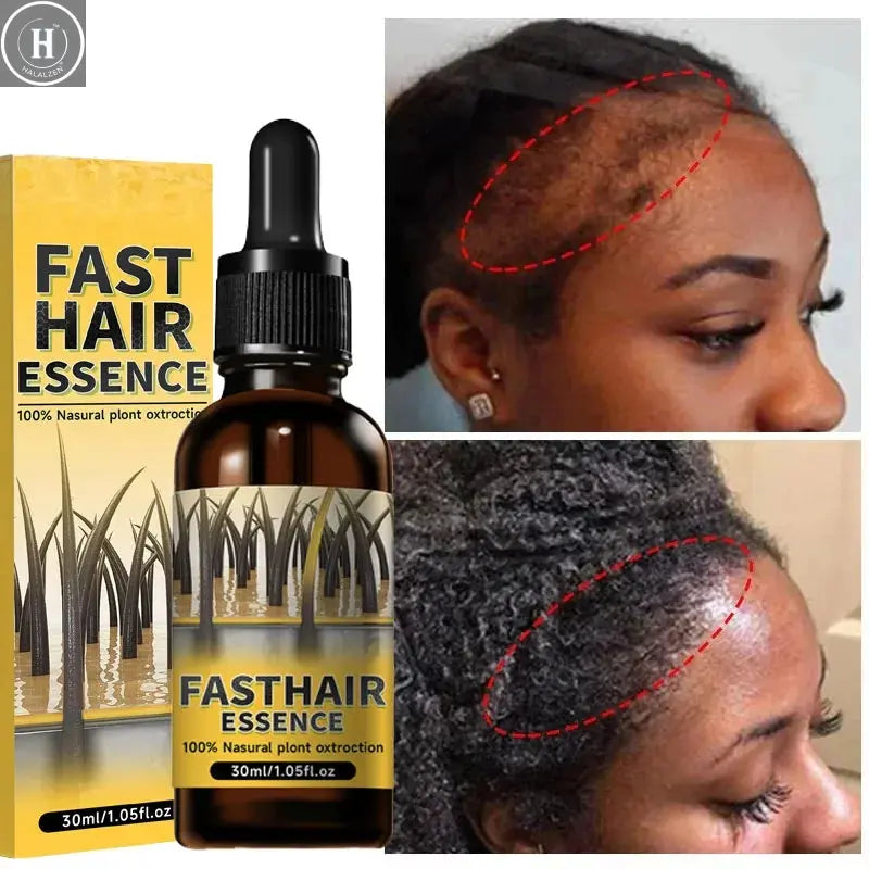Hair growth plant essence oil beauty care anti hair loss essence natural repair damaged hair HALALZEN