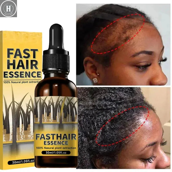 Hair growth plant essence oil beauty care anti hair loss essence natural repair damaged hair HALALZEN