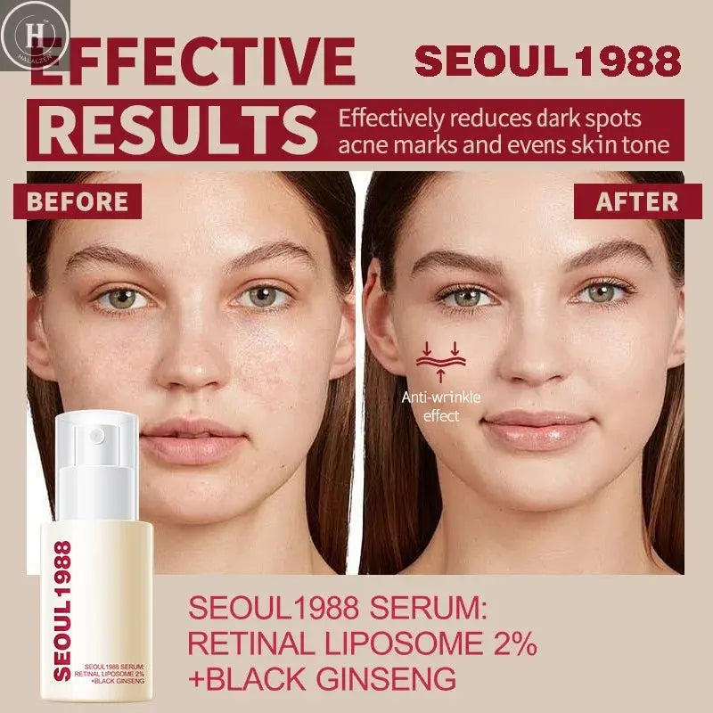 1/2/3PCS Korean SEOUL 1988 Retinol Face Serum Fade Fine Wrinkle Moisturizing Whitening Remove Spot Shrink Pores Beauty Skin Care HALALZEN