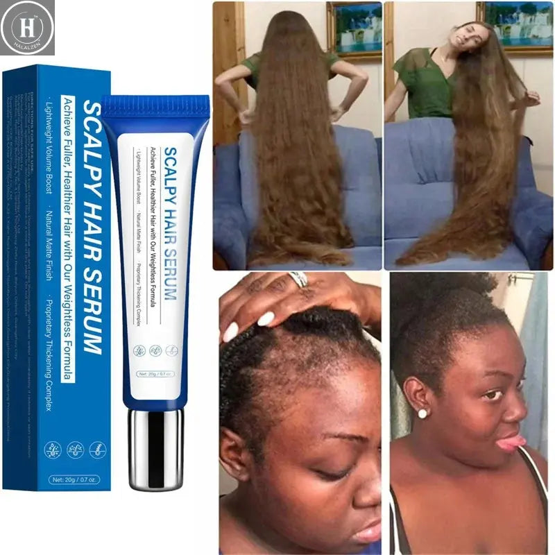 Fast Hair Growth Serum Hair Regrowth Essential Oil Anti Hair loss Repair Damaged Scalp Women Men Anti Baldness Hair Growth Care HALALZEN